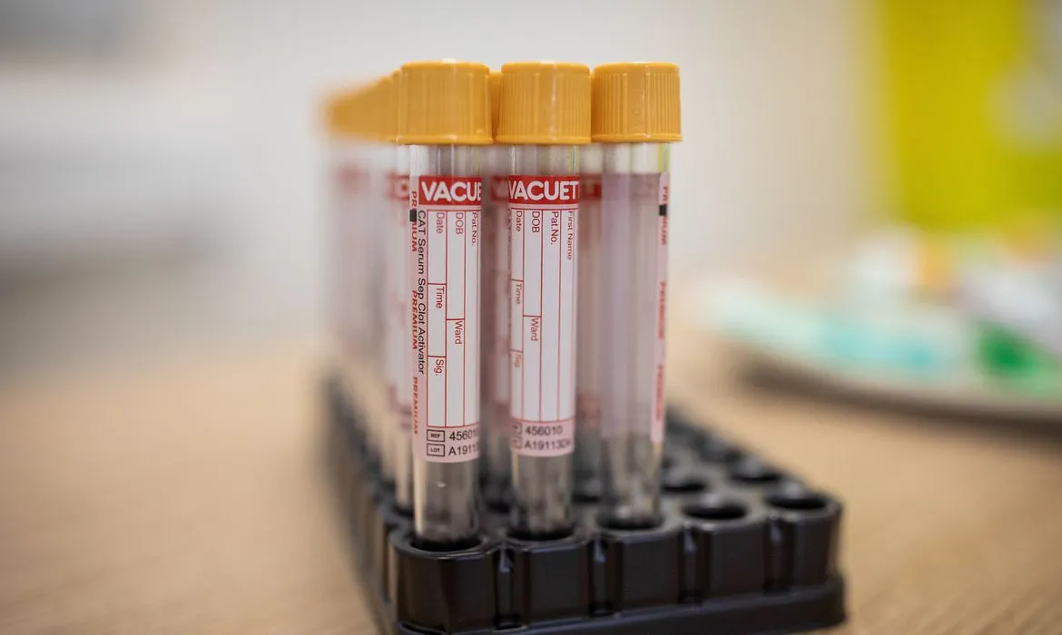 ​Itaituba registra mais um óbito por Covid-19 e 21 novos casos da doença