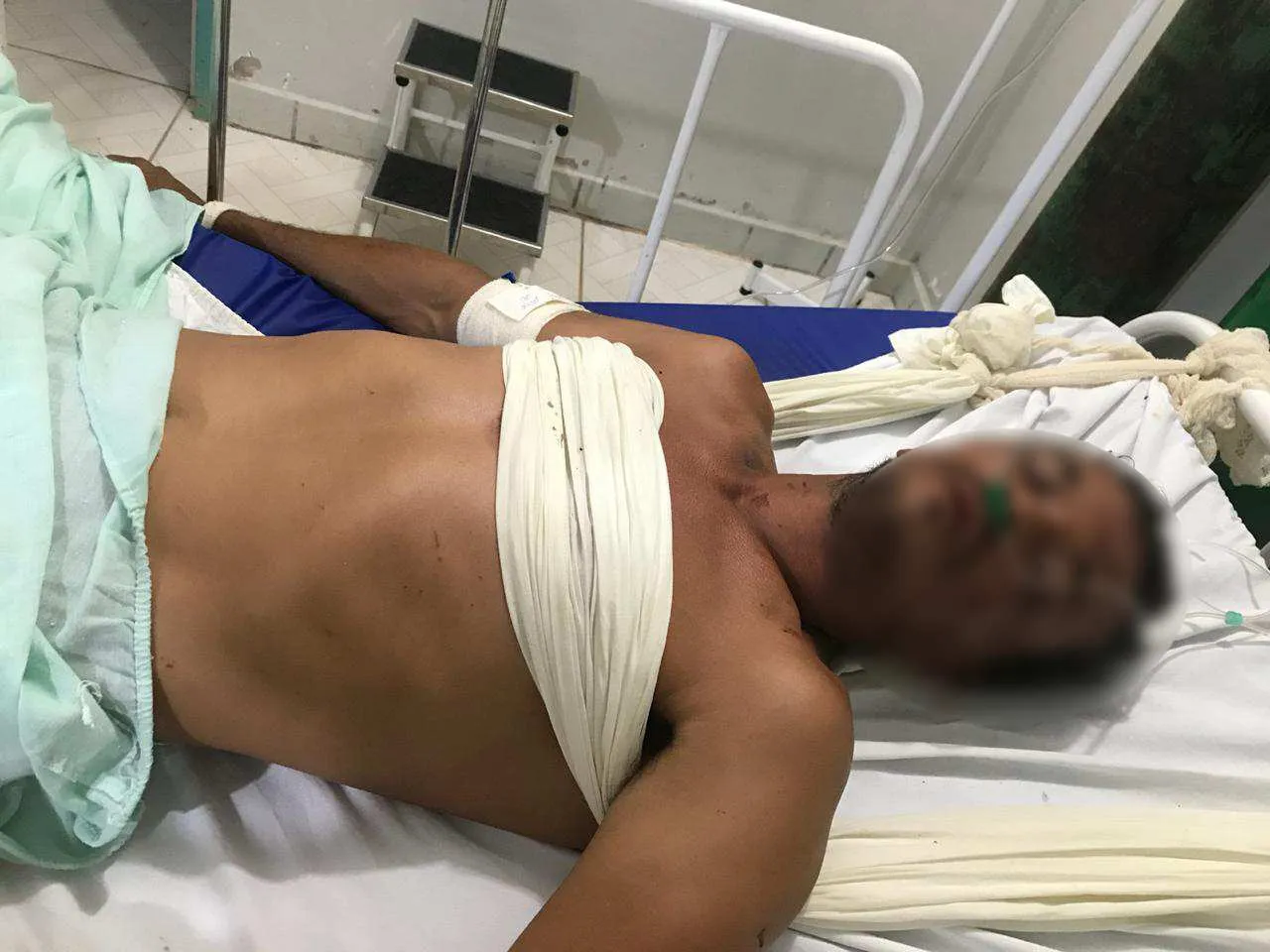 Adelmiro Gonçalves Valm foi espancado por três homens em Moraes Almeida.