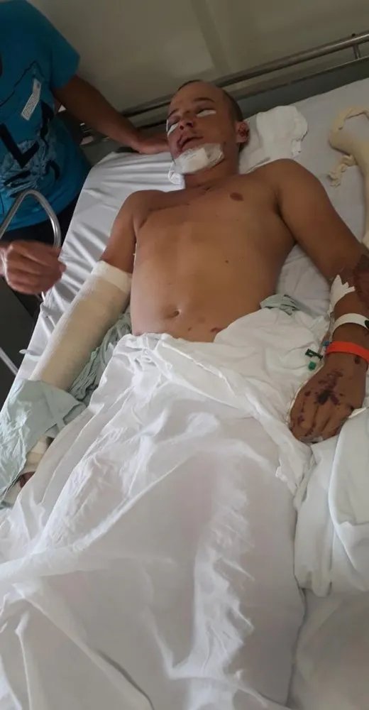 Jovem após as cirurgias que aconteceram na tarde desta sexta-feira (03)