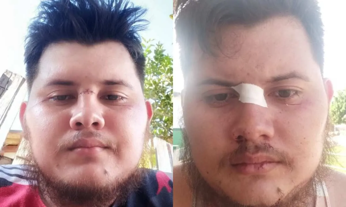Robson Santos foi mais uma vítima.