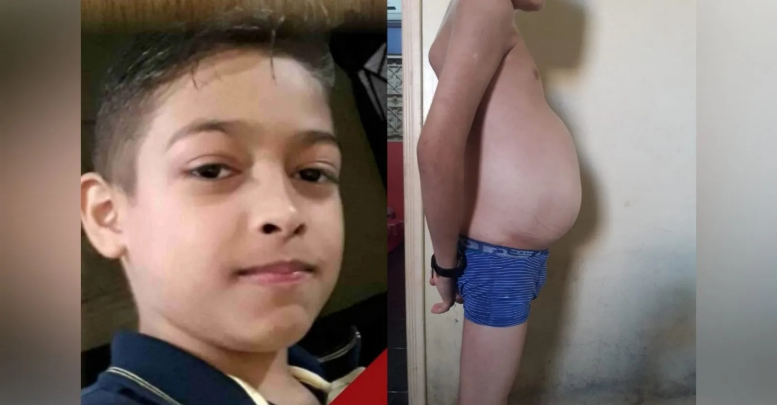 12 anos.