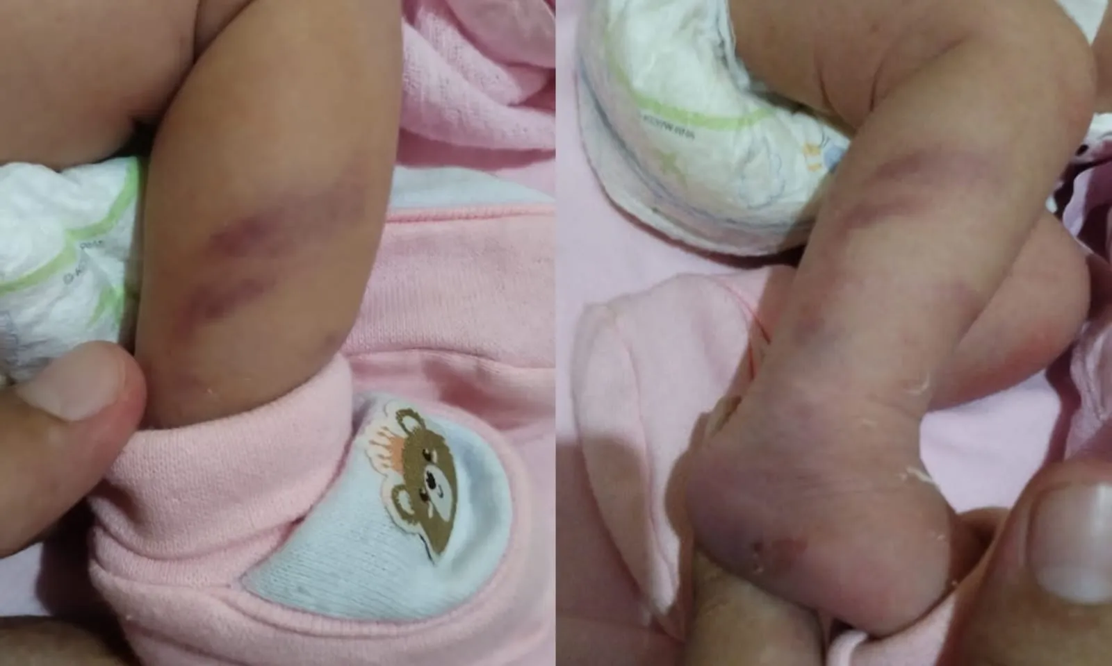 "É apenas uma recém-nascida, não necessita de tanta força", diz pai ao denunciar atendimento de Posto de Saúde durante Teste do Pezinho, em Itaituba